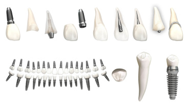 Visuel d’illustrations 3D de schémas dentaires avec appareillages